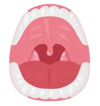口内炎